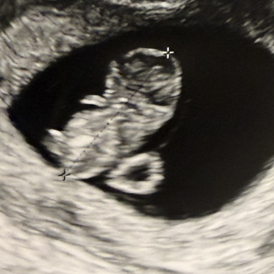 Photo shared by Addison for their Babylist baby registry.