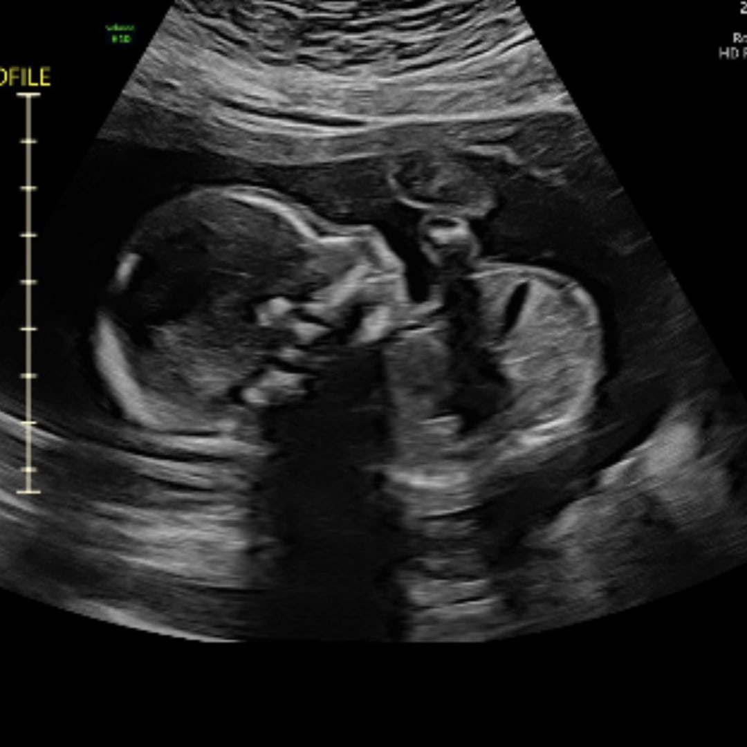 Photo shared by Christine for their Babylist baby registry.