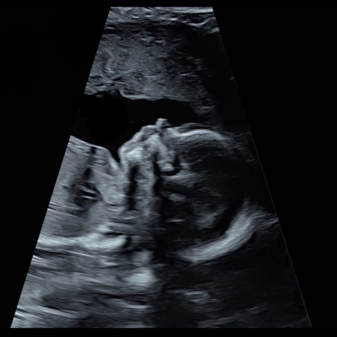 Photo shared by Maggie for their Babylist baby registry.