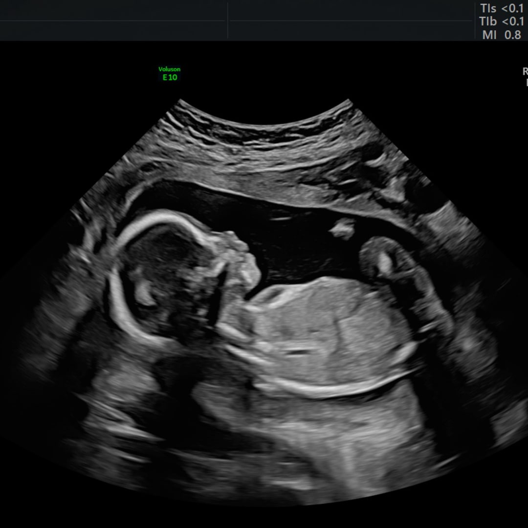 Photo shared by Cheyenne for their Babylist baby registry.