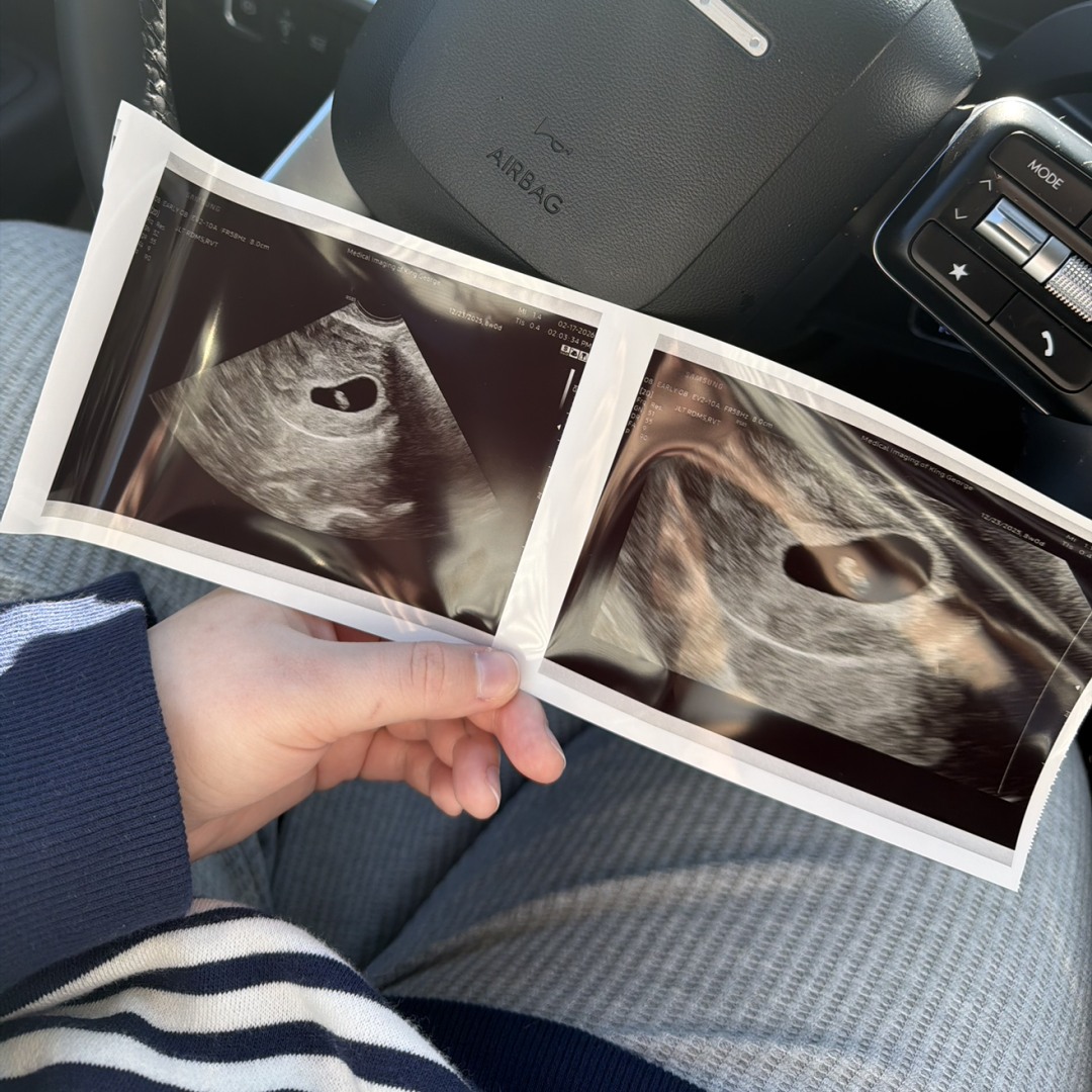 Photo shared by Megan for their Babylist baby registry.