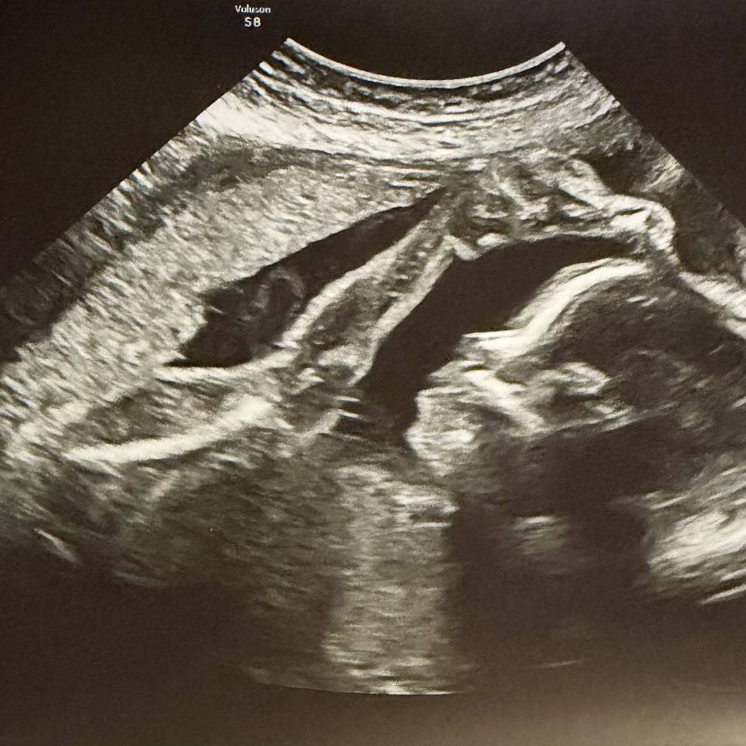 Photo shared by Alexa for their Babylist baby registry.