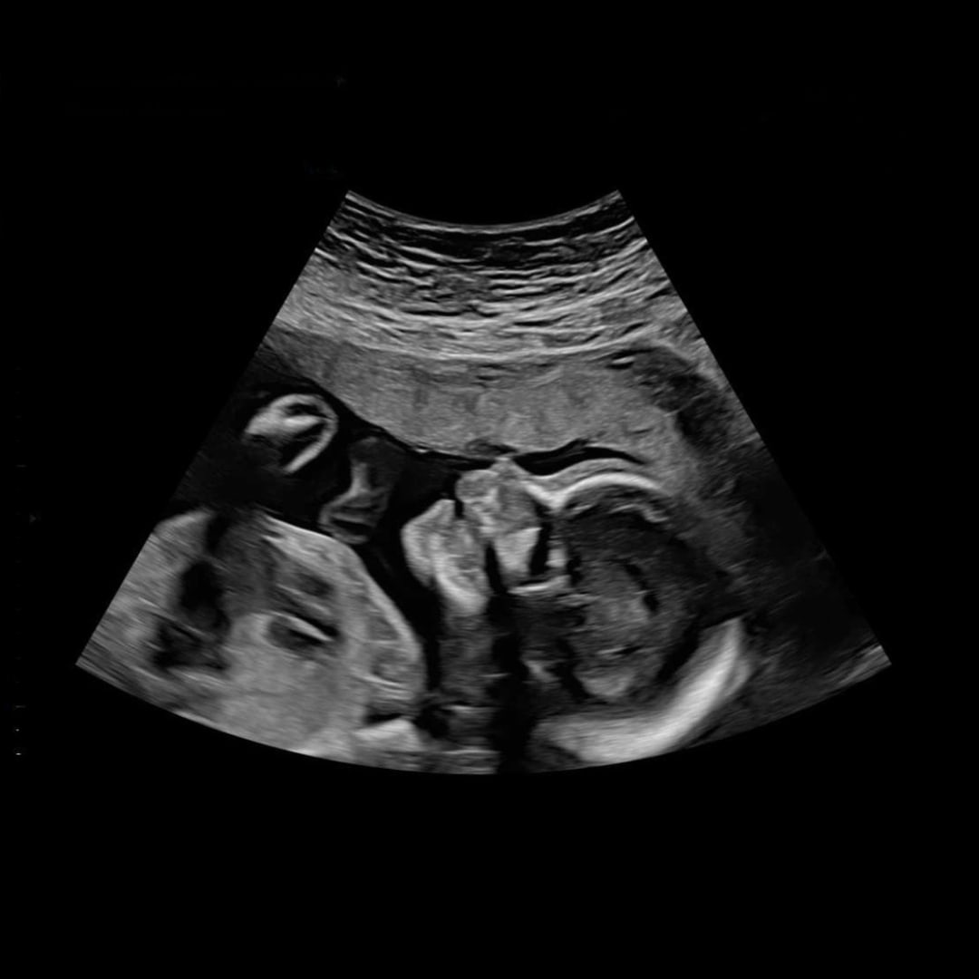 Photo shared by Chantelle for their Babylist baby registry.