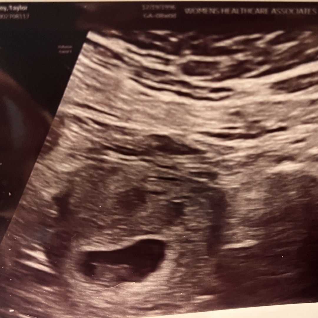 Photo shared by Taylor for their Babylist baby registry.