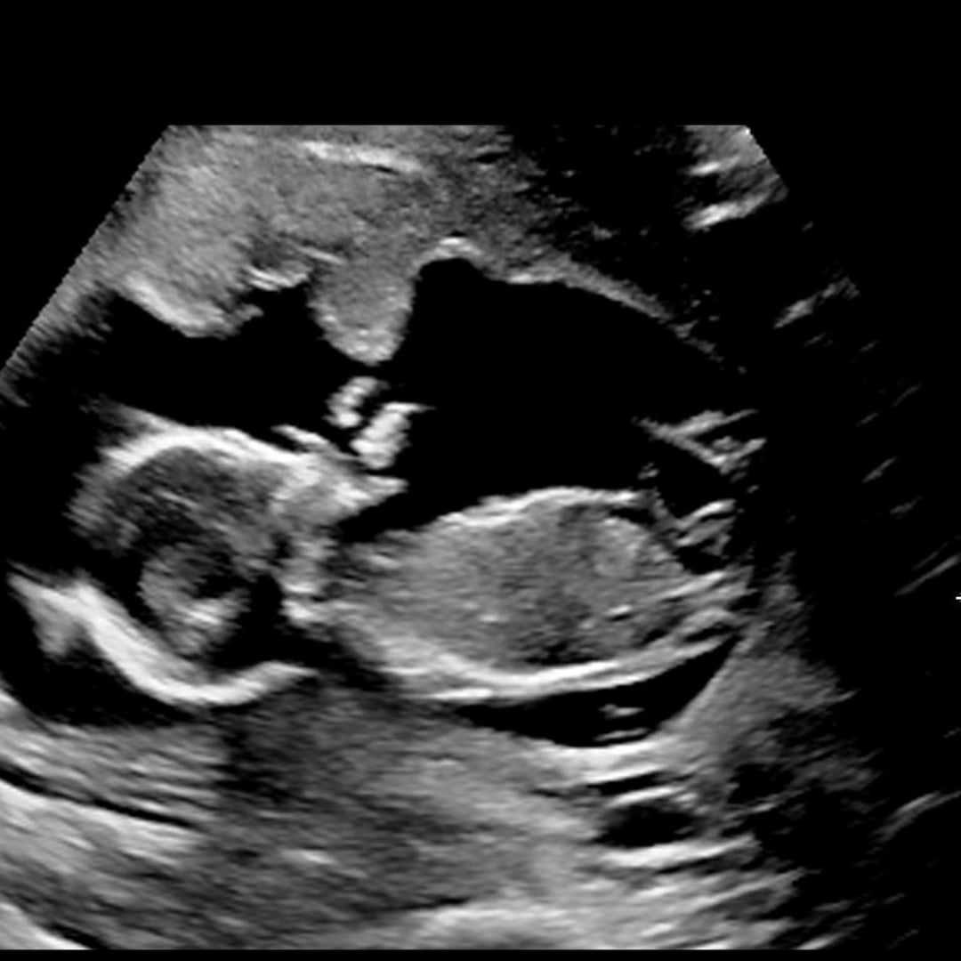 Photo shared by Rijdyna for their Babylist baby registry.