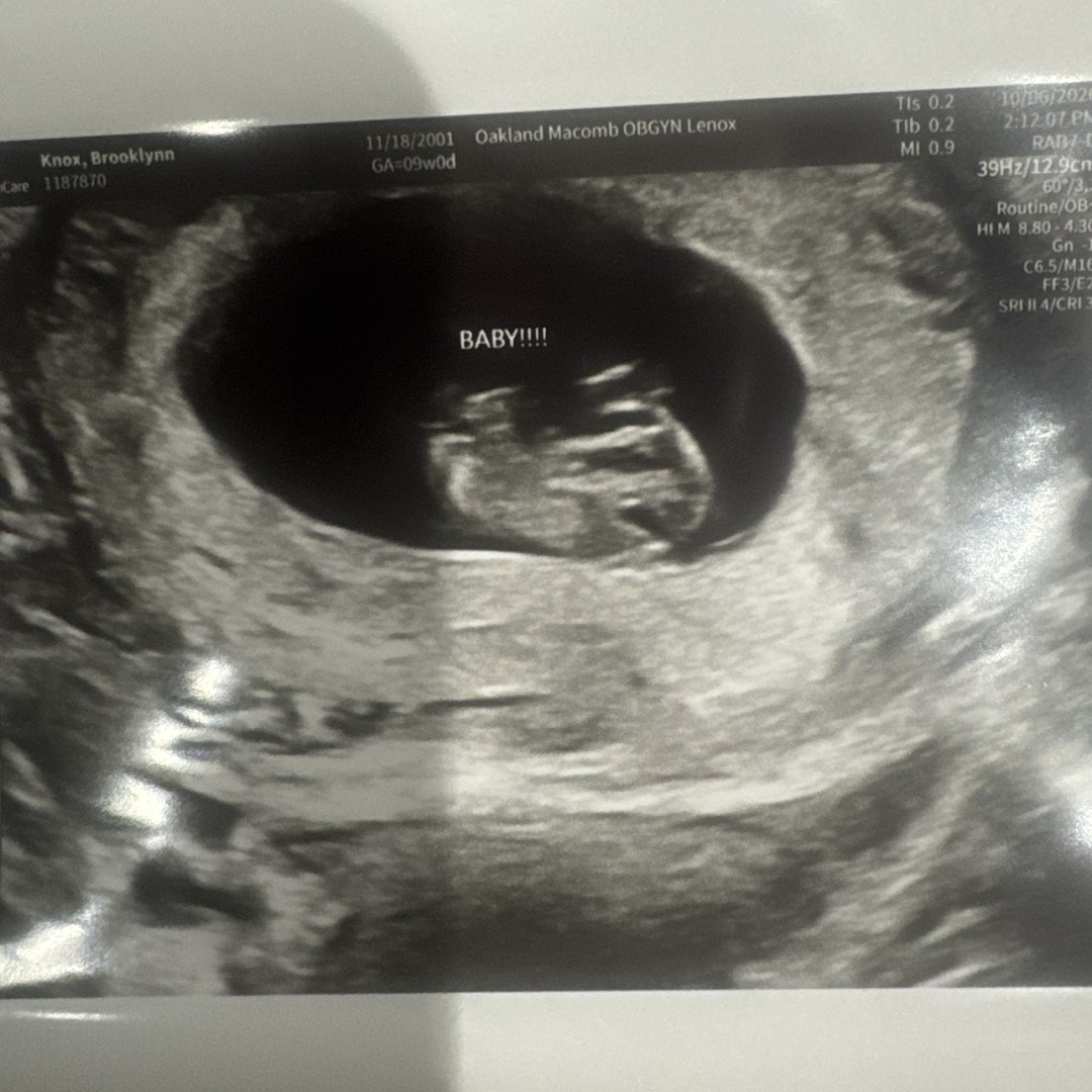 Photo shared by Brooklynn for their Babylist baby registry.