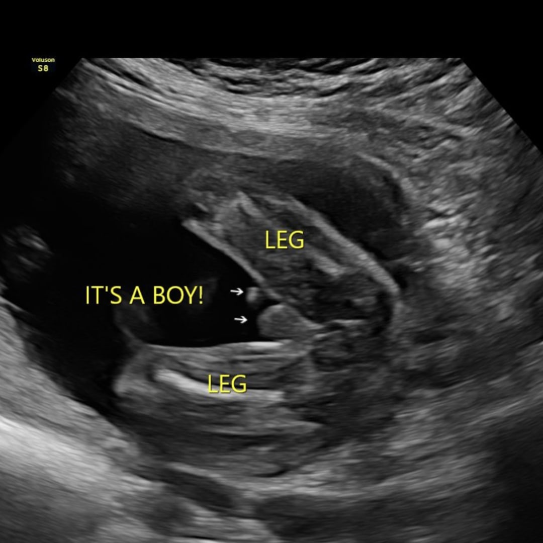 Photo shared by Micah for their Babylist baby registry.