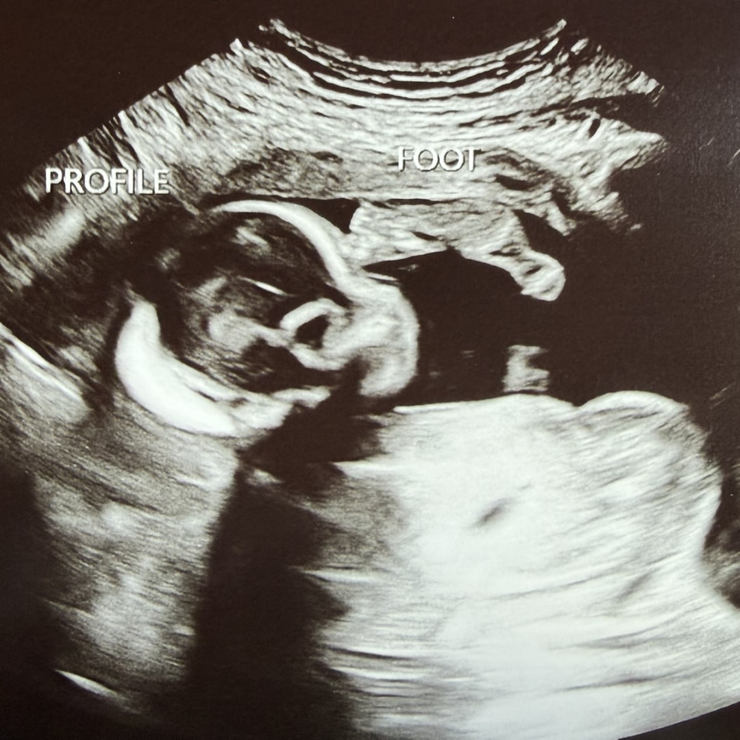 Photo shared by Cereza for their Babylist baby registry.