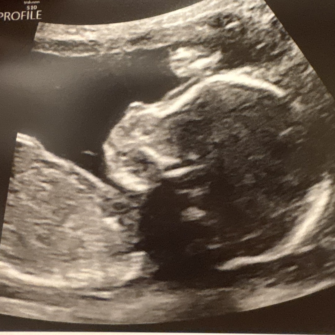 Photo shared by Abigail for their Babylist baby registry.