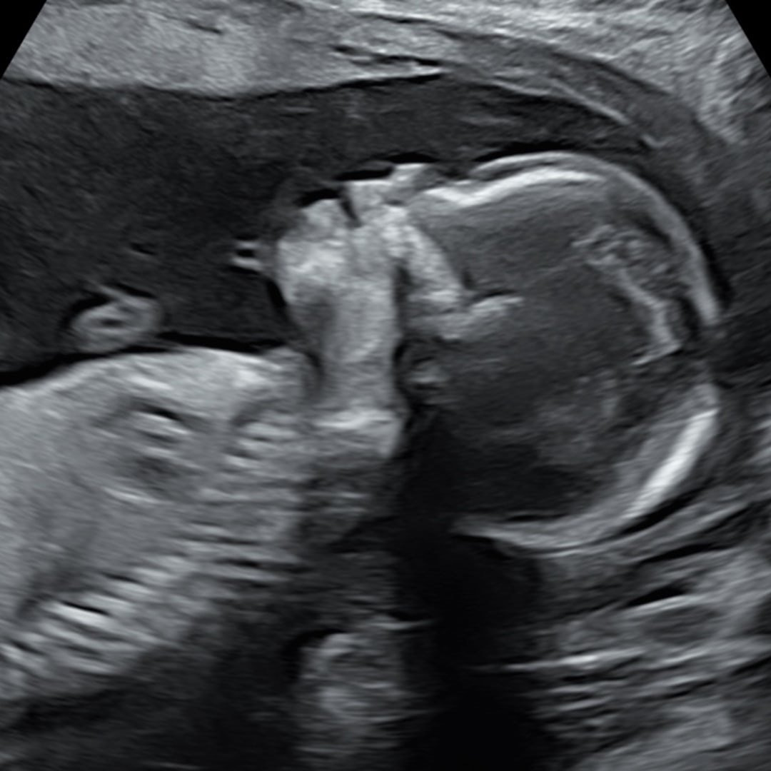 Photo shared by Keoni for their Babylist baby registry.