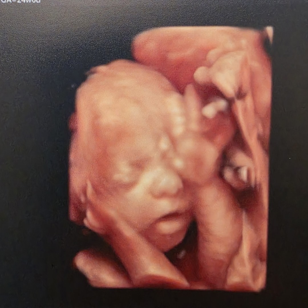 Photo shared by Brittany for their Babylist baby registry.