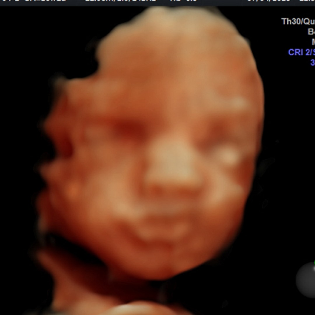 Photo shared by Emily for their Babylist baby registry.