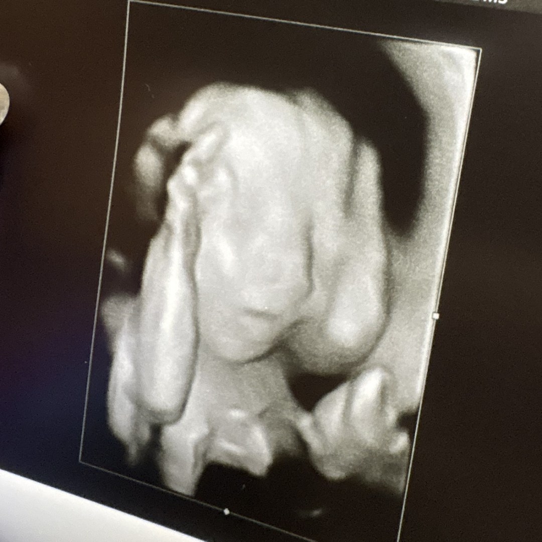 Photo shared by Brigette for their Babylist baby registry.