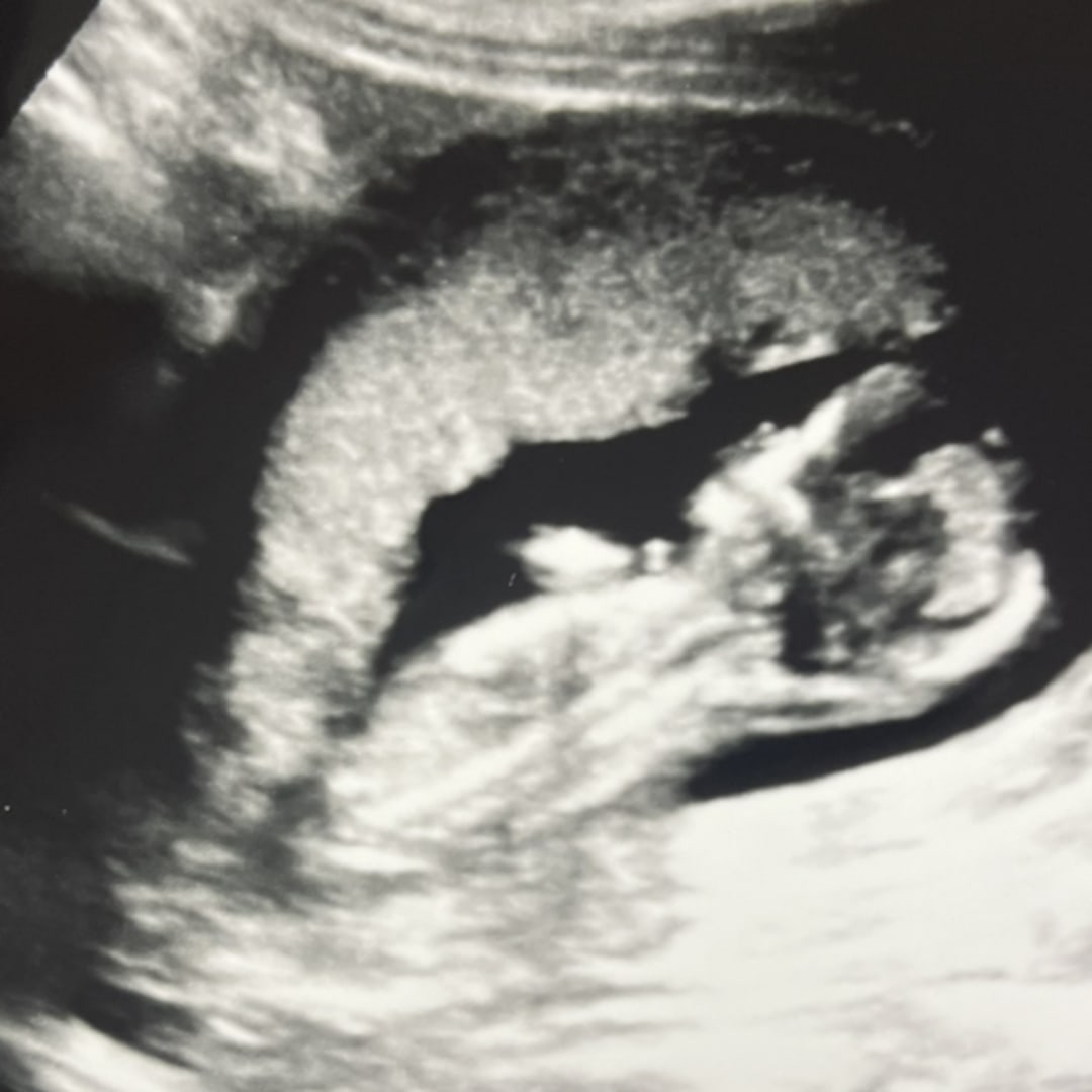 Photo shared by Kamari for their Babylist baby registry.