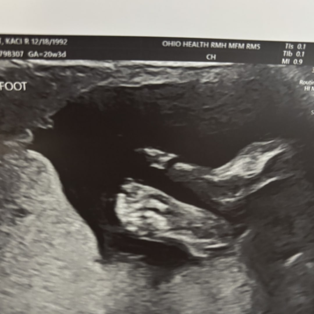 Photo shared by Kaci for their Babylist baby registry.
