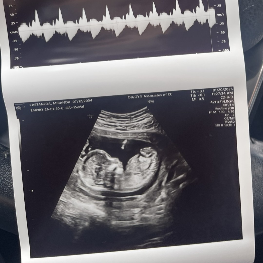 Photo shared by Alexandria for their Babylist baby registry.