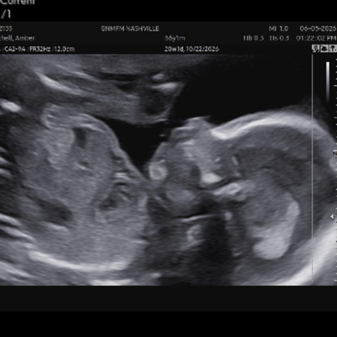 Photo shared by Amber for their Babylist baby registry.
