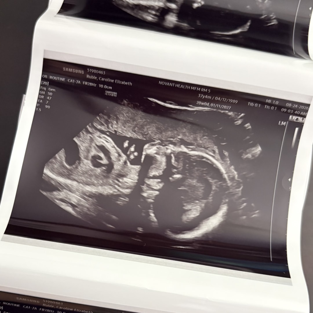 Photo shared by Caroline for their Babylist baby registry.