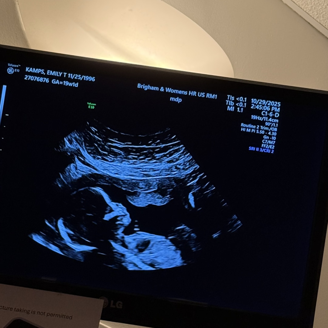 Photo shared by Emily for their Babylist baby registry.