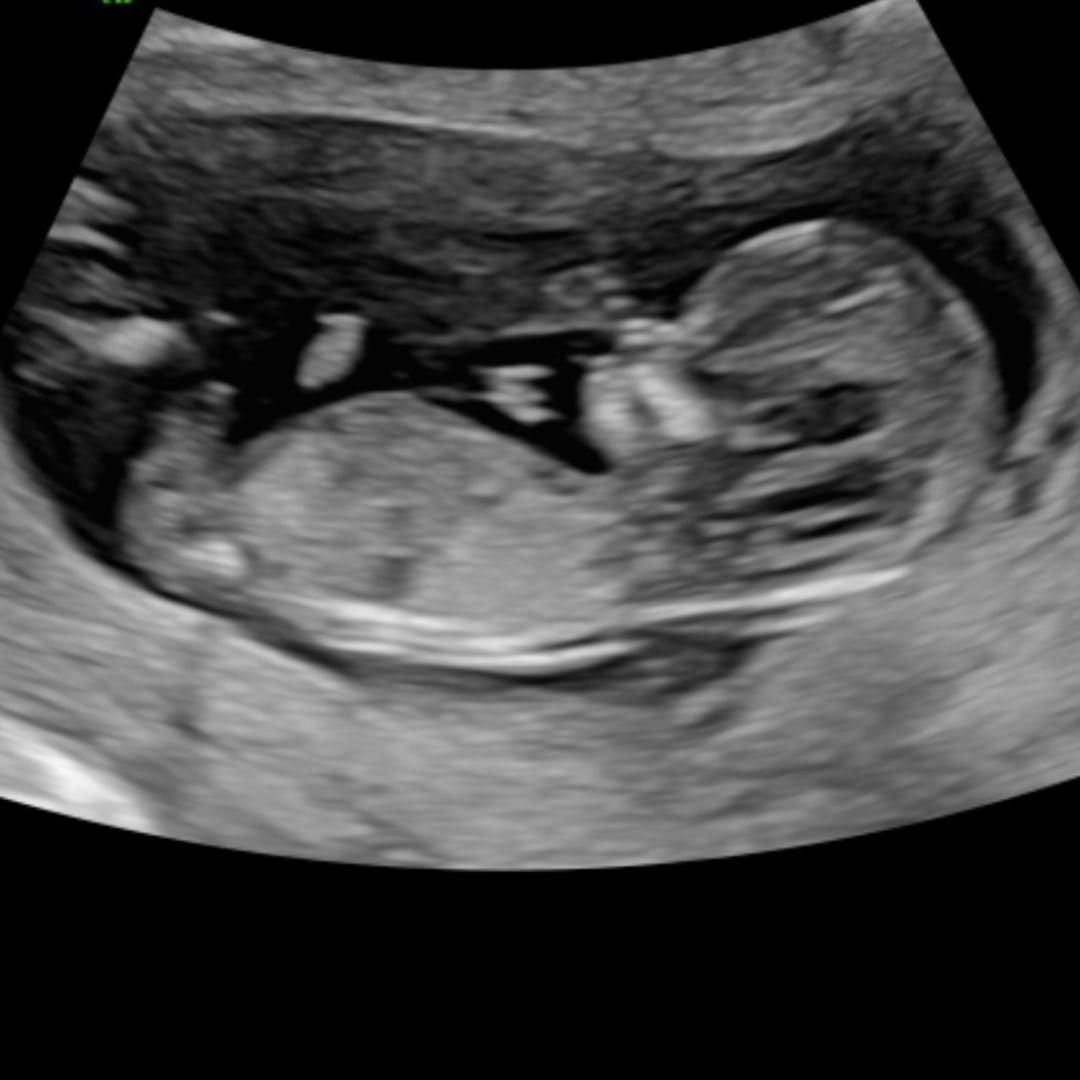 Photo shared by Dayshea for their Babylist baby registry.