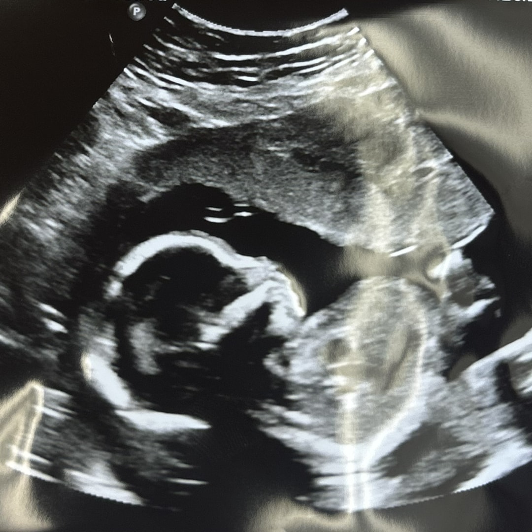 Photo shared by Jackie for their Babylist baby registry.