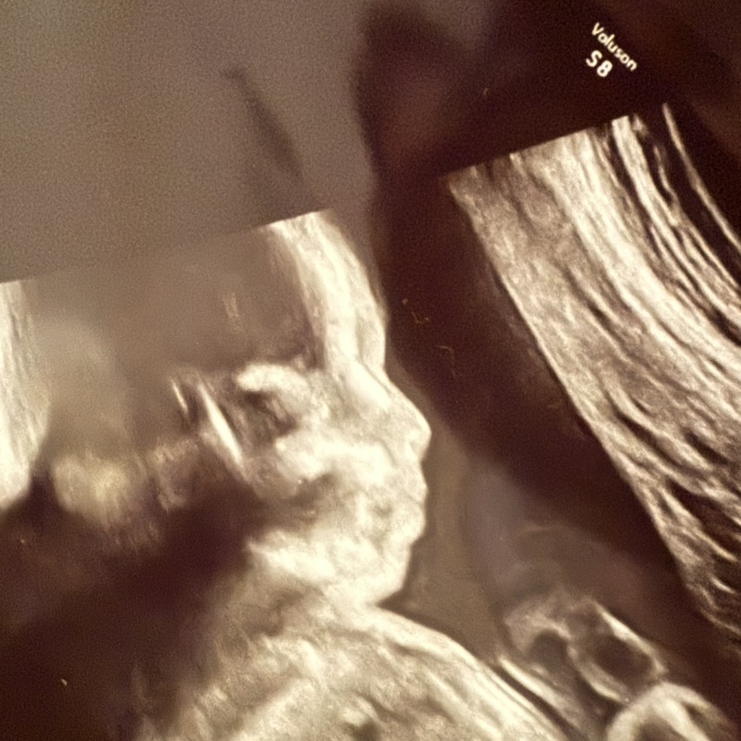 Photo shared by Katie for their Babylist baby registry.