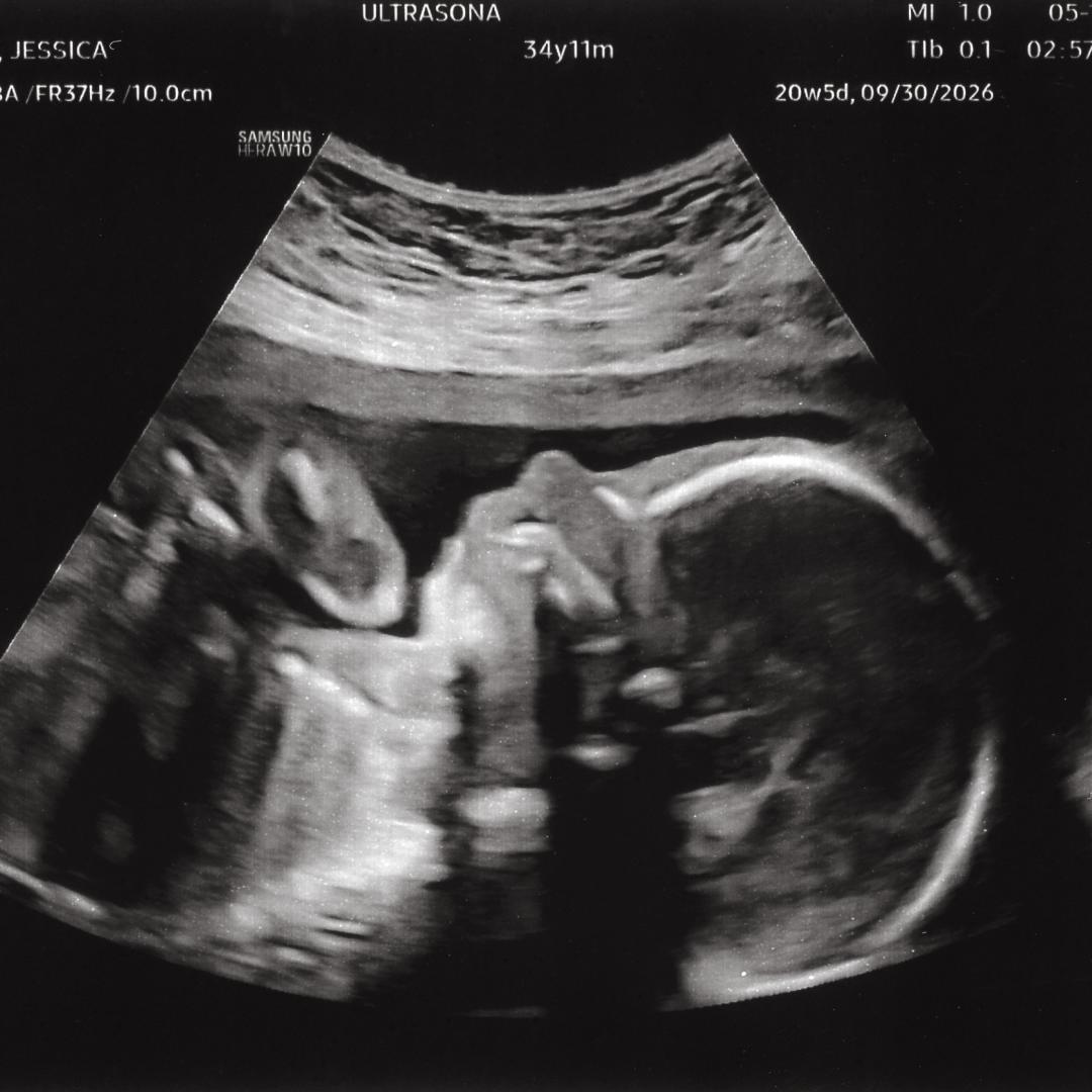 Photo shared by Jess for their Babylist baby registry.
