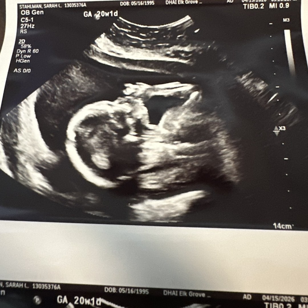 Photo shared by Sarah for their Babylist baby registry.