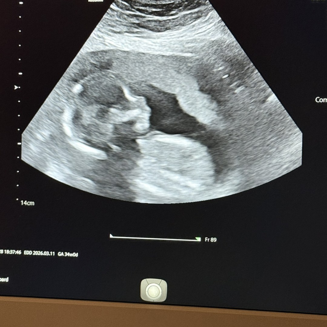 Photo shared by Allison for their Babylist baby registry.