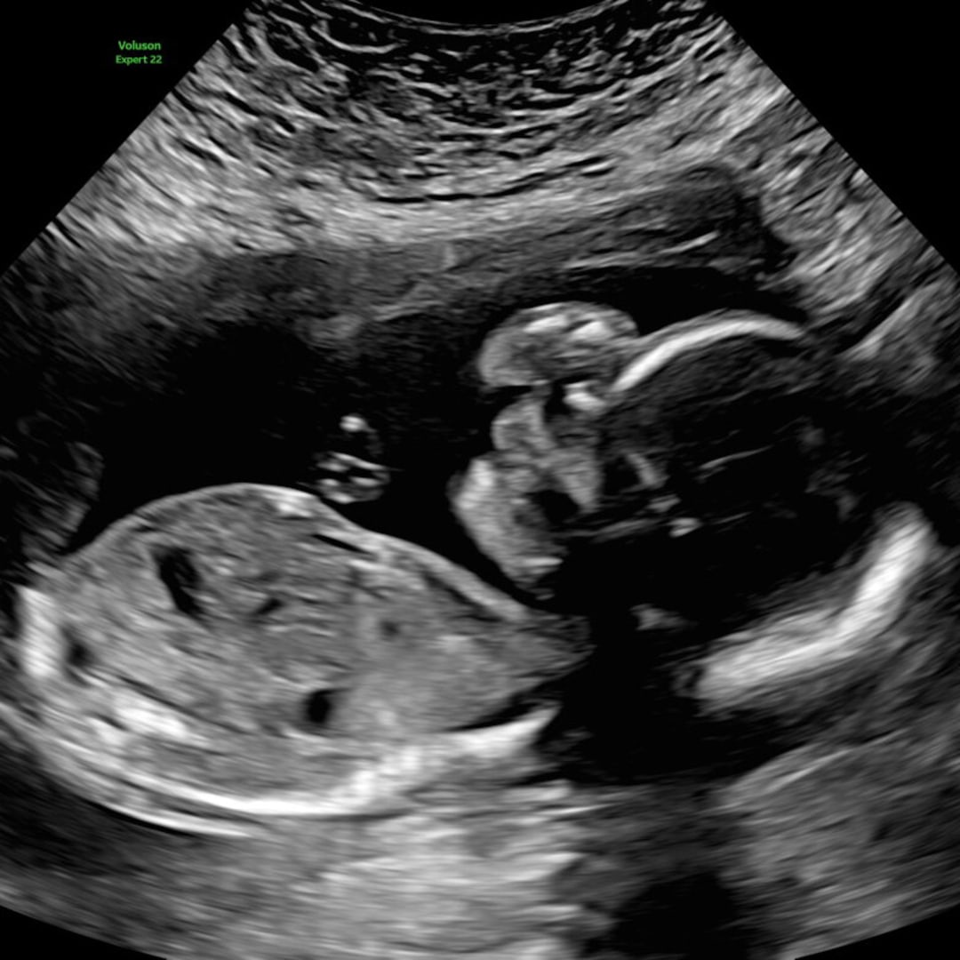 Photo shared by Brittney for their Babylist baby registry.