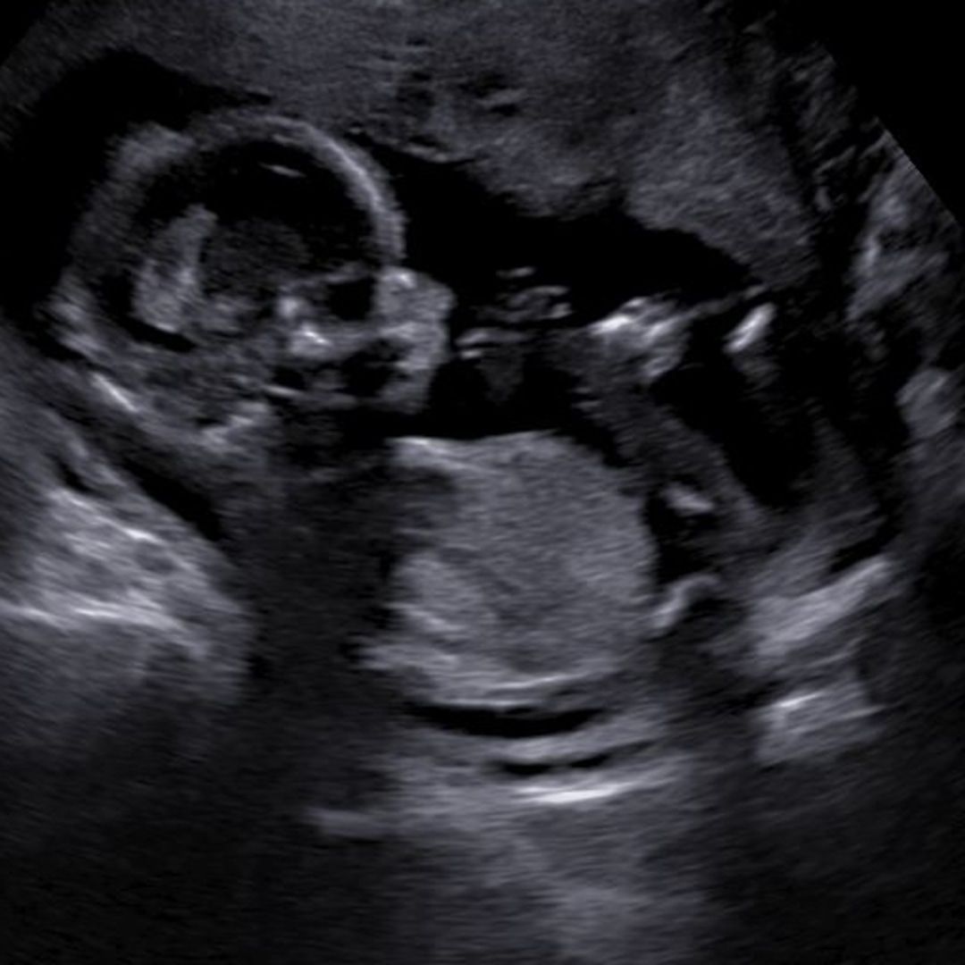 Photo shared by Emma for their Babylist baby registry.
