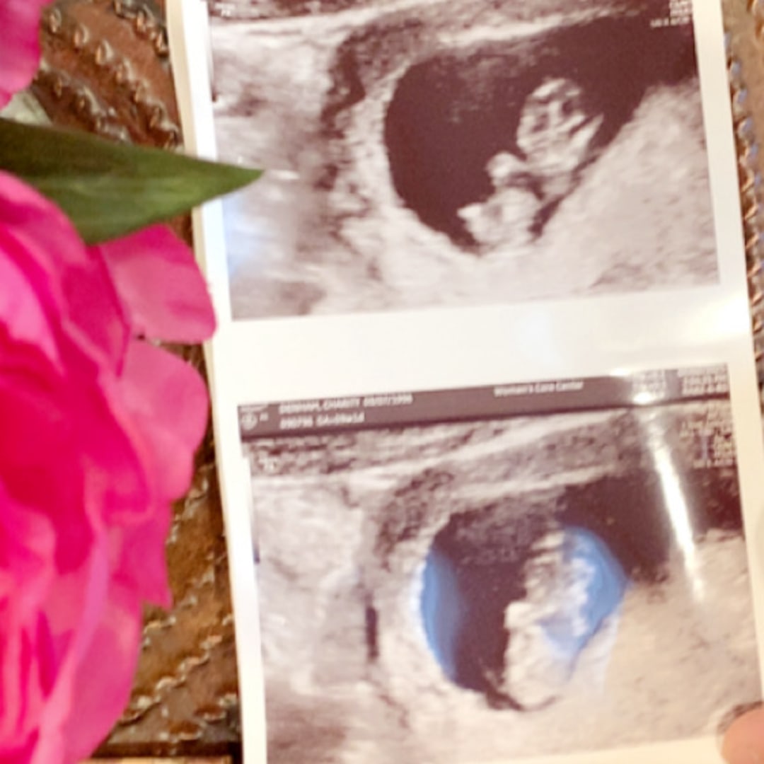 Photo shared by Charity for their Babylist baby registry.