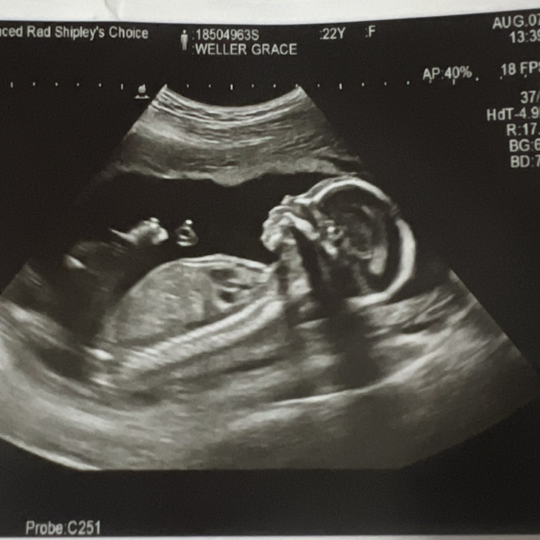 Photo shared by Grace for their Babylist baby registry.