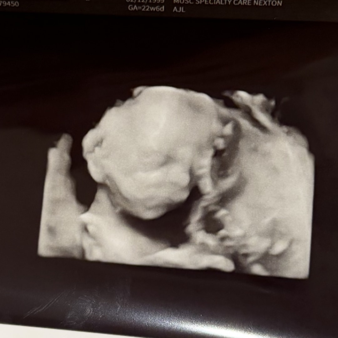 Photo shared by Taylor for their Babylist baby registry.