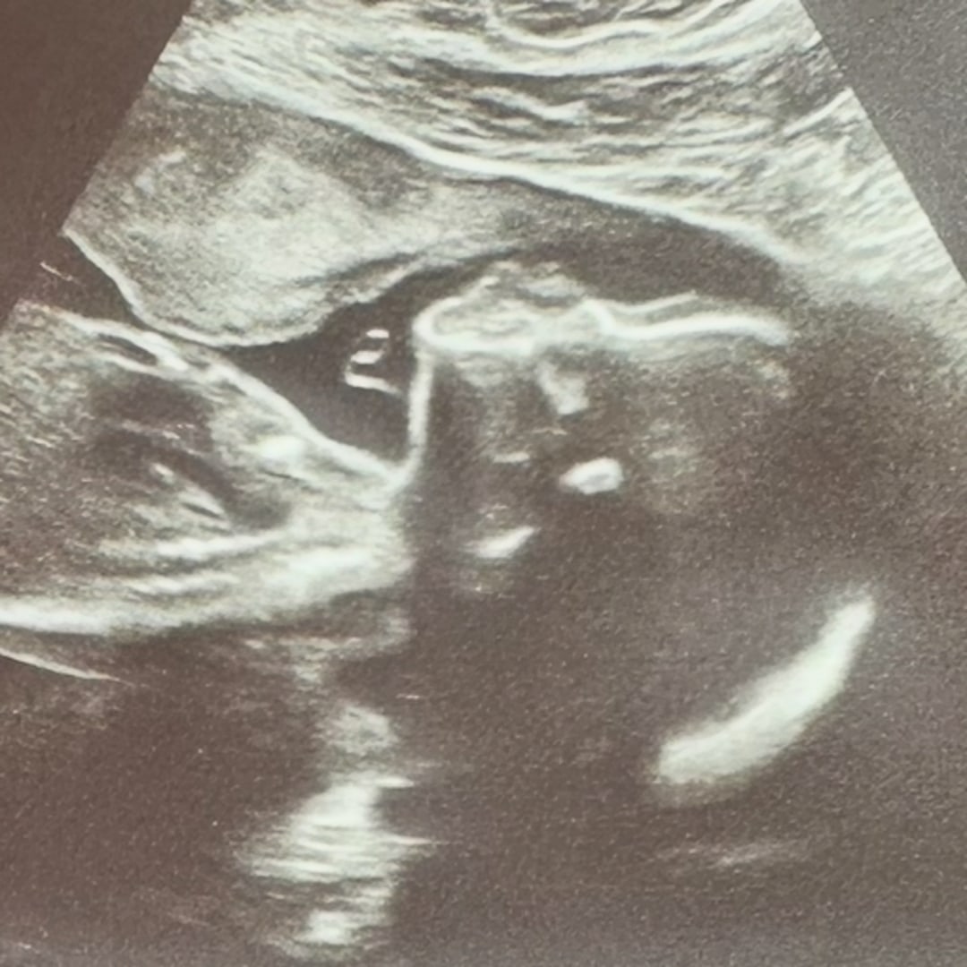 Photo shared by Hayley for their Babylist baby registry.