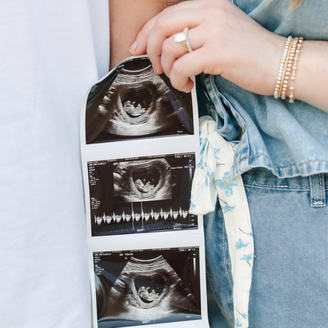 Photo shared by Kelly for their Babylist baby registry.
