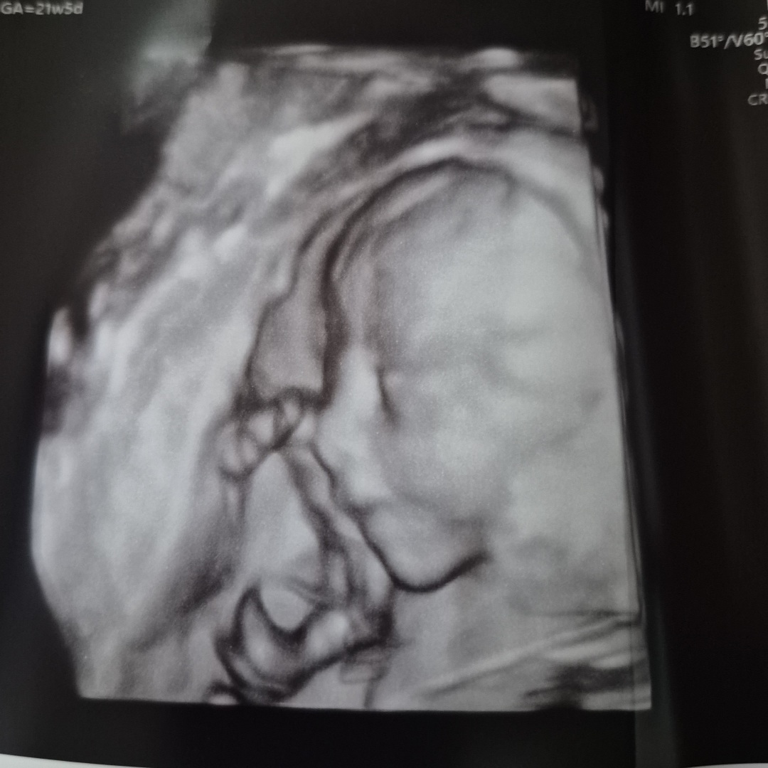 Photo shared by Yosi & Meg for their Babylist baby registry.