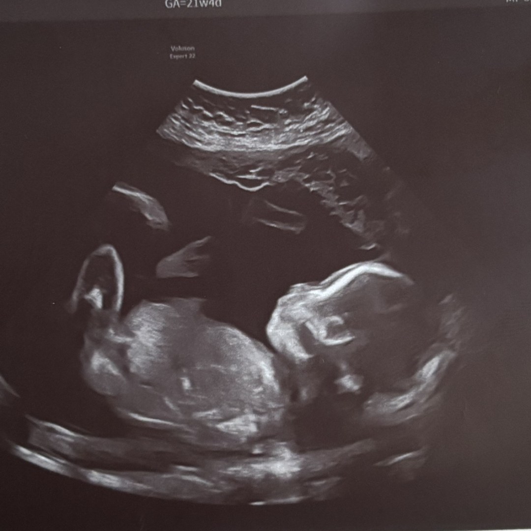 Photo shared by Cierra and Daniel for their Babylist baby registry.