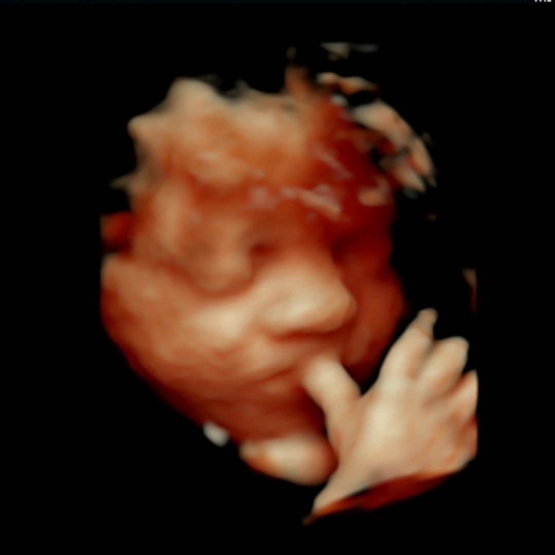 Photo shared by Kaylee for their Babylist baby registry.
