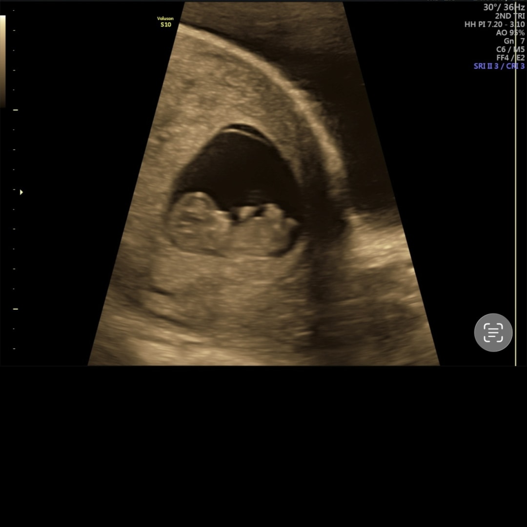 Photo shared by Ashley for their Babylist baby registry.