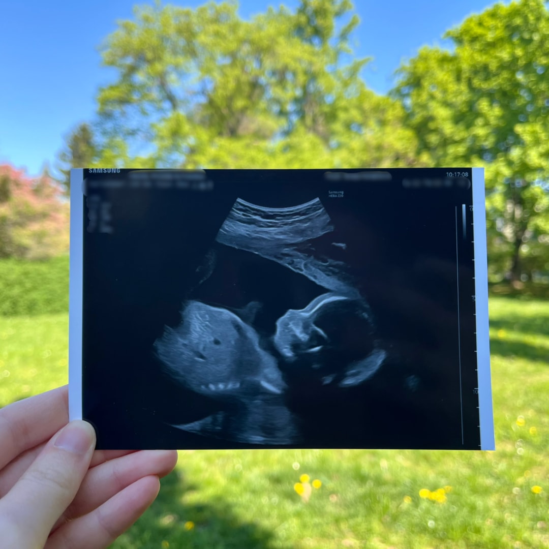 Photo shared by Phoebe for their Babylist baby registry.