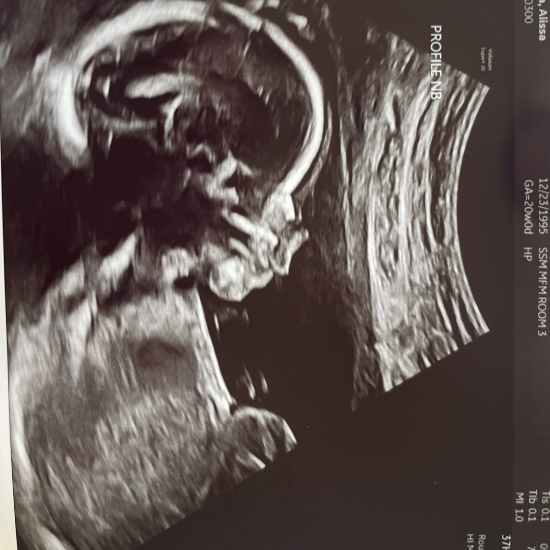 Photo shared by Alissa for their Babylist baby registry.