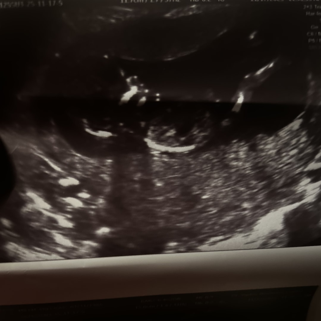 Photo shared by Dionne for their Babylist baby registry.