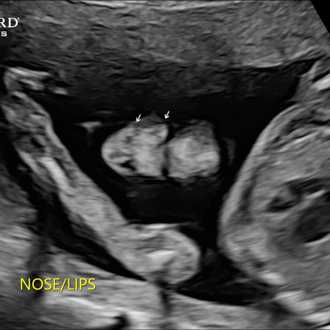 Photo shared by Brenna for their Babylist baby registry.