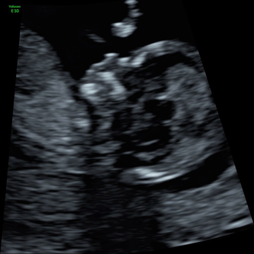 Photo shared by Megan for their Babylist baby registry.