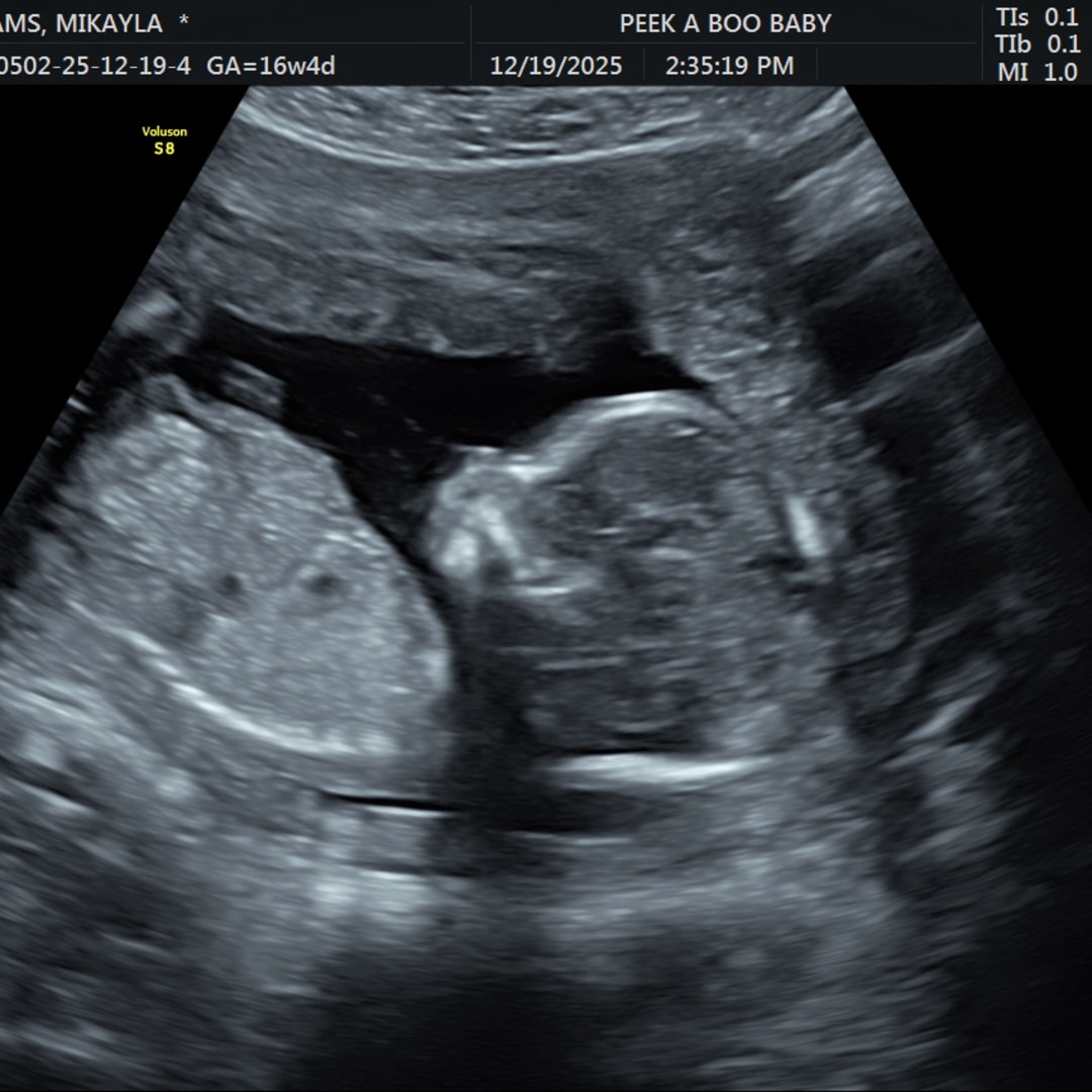 Photo shared by Mikayla for their Babylist baby registry.
