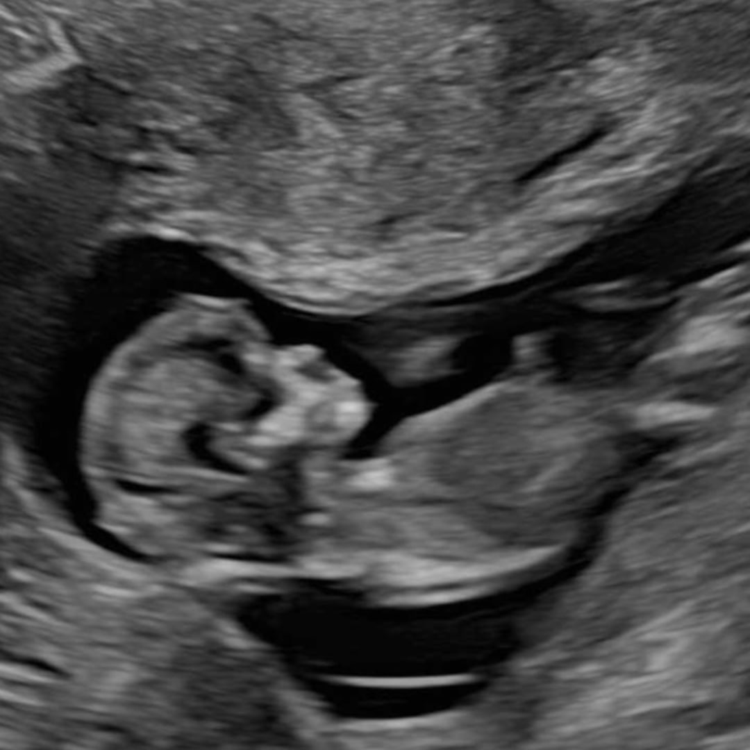 Photo shared by Kristina for their Babylist baby registry.