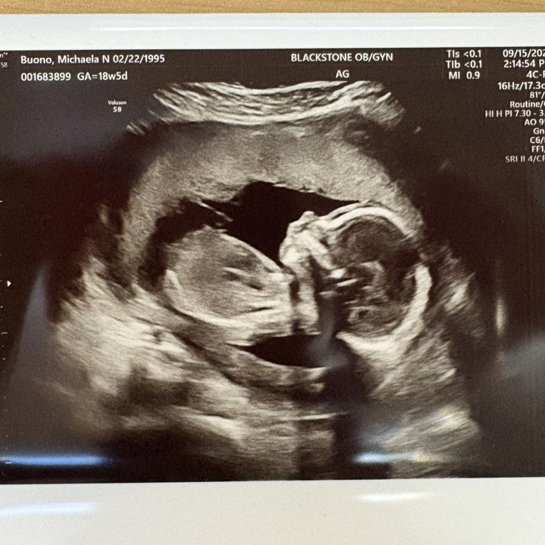 Photo shared by Michaela for their Babylist baby registry.