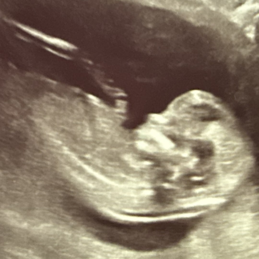 Photo shared by Graziella for their Babylist baby registry.