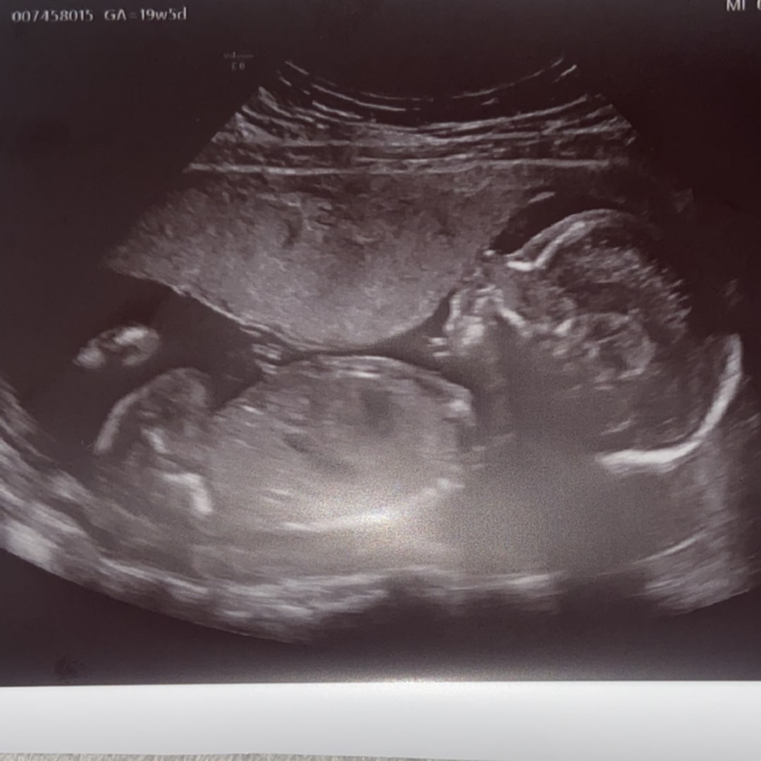 Photo shared by Aracelis for their Babylist baby registry.